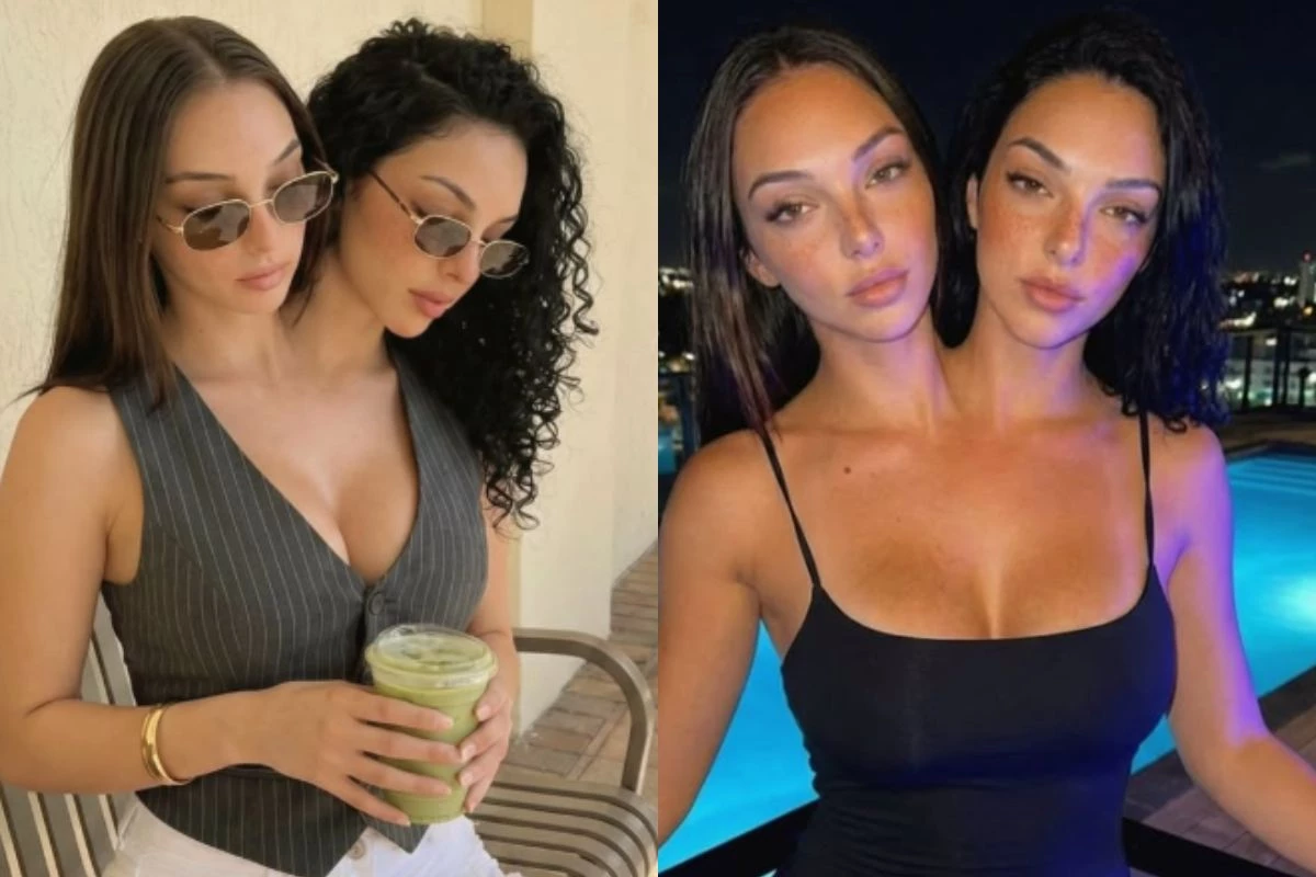 Chega a verdade sobre ”gêmeas siamesas” que fazem um tremendo sucesso